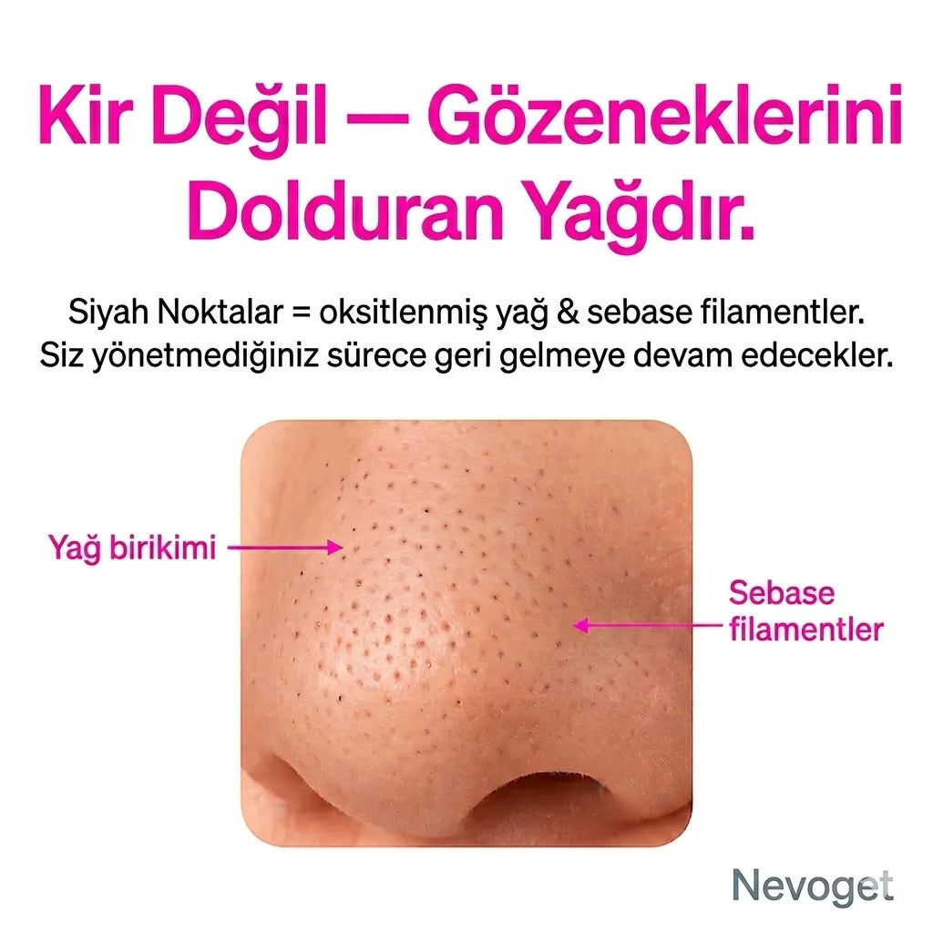 Nevoget Vakumlu Siyah Nokta Temizleme Cihazı
