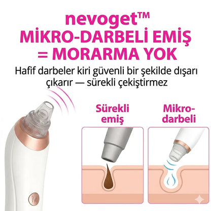 Nevoget Vakumlu Siyah Nokta Temizleme Cihazı