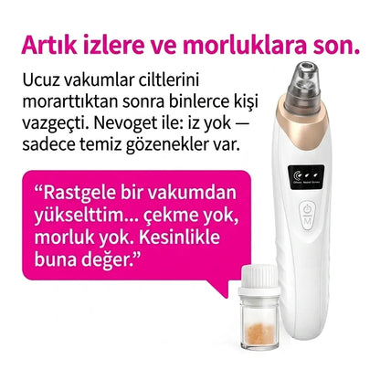 Nevoget Vakumlu Siyah Nokta Temizleme Cihazı