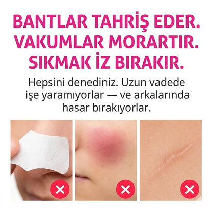 Nevoget Vakumlu Siyah Nokta Temizleme Cihazı